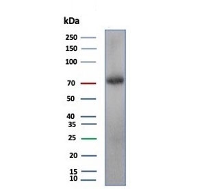 Western blot testing of human testis tissue lysate with Kinesin like protein 6 antibody (clone KIF2C/4704) at 2ug/ml. Predicted molecular weight 76-81 kDa.