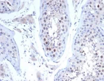 IHC staining of FFPE human testis tissue with Kinesin like protein 6 antibody (clone KIF2C/4704) at 2ug/ml. HIER: boil tissue sections in pH 9 10mM Tris with 1mM EDTA for 20 min and allow to cool before testing.