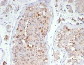 IHC staining of FFPE human testis tissue with KIF2C antibody (clone KIF2C/4706) at 2ug/ml. HIER: boil tissue sections in pH 9 10mM Tris with 1mM EDTA for 20 min and allow to cool before testing.~