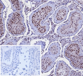IHC staining of FFPE human testis tissue with Kinesin Family Member 2C antibody (clone KIF2C/4707) at 2ug/ml. Inset: PBS used in place of primary Ab (secondary Ab negative control). HIER: boil tissue sections in pH 9 10mM Tris with 1mM EDTA for 20 min and allow to cool before testing.~