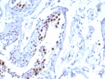 IHC staining of FFPE human testis tissue with Kinesin Family Member 2C antibody (clone KIF2C/6518) at 2ug/ml. HIER: boil tissue sections in pH 9 10mM Tris with 1mM EDTA for 20 min and allow to cool before testing.~