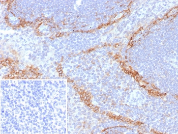 IHC staining of FFPE human tonsil tissue with recombinant PDPN antibody (clone rPDPN/6994). Inset: PBS used in place of primary Ab (secondary Ab negative control). HIER: boil tissue sections in pH 9 10mM Tris with 1mM EDTA for 20 min and allow to cool before testing.~