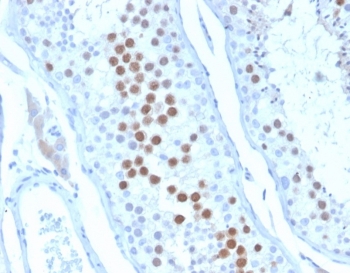 IHC staining of FFPE human testis tissue with KIF2C antibody (clone KIF2C/6528) at 2ug/ml. HIER: boil tissue sections in pH 9 10mM Tris with 1mM EDTA for 20 min and allow to cool before testing.~