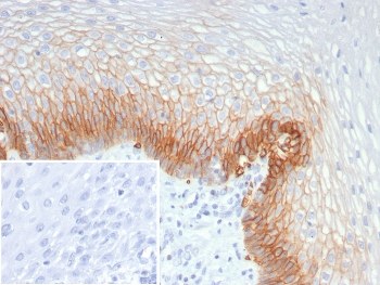 IHC staining of FFPE human esophagus tissue with SLC2A1 antibody (clone GLUT1/7308). Inset: PBS used in place of primary Ab (secondary Ab negative control). HIER: boil tissue sections in pH 9 10mM Tris with 1mM EDTA for 20 min and allow to cool before testing.~