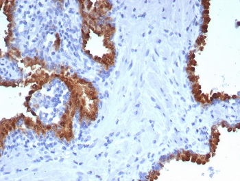 IHC staining of FFPE human prostate tissue with PTPRU antibody (clone PTPRU/7616). HIER: boil tissue sections in pH 9 10mM Tris with 1mM EDTA for 20 min and allow to cool before testing.~