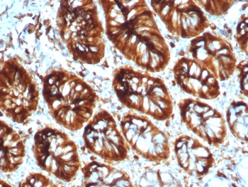 IHC staining of FFPE human colon tissue with Stathmin 1 antibody (clone STMN1/8012). HIER: boil tissue sections in pH 9 10mM Tris with 1mM EDTA for 20 min and allow to cool before testing.~