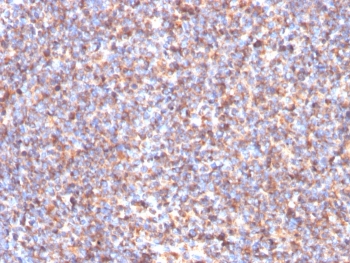 IHC staining of FFPE human tonsil tissue with Succinate dehydrogenase B antibody (clone SDHB/3204). HIER: boil tissue sections in pH 9 10mM Tris with 1mM EDTA for 20 min and allow to cool before testing.~