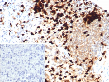 IHC staining of FFPE human spleen tissue with S100A9 antibody (clone S100A9/7550). Inset: PBS used in place of primary Ab (secondary Ab negative control). HIER: boil tissue sections in pH 9 10mM Tris with 1mM EDTA for 20 min and allow to cool before testing.~