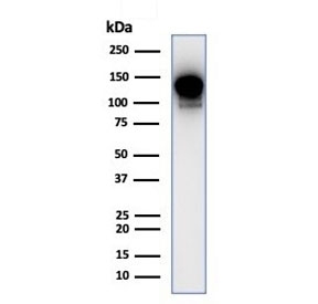 Western blot testing of human THP-1 cell lysate with PIK3CD antibody (clone PIK3CD/4639). Expected molecular weight: 110-120 kDa.~