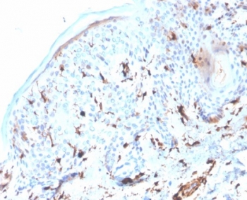 IHC staining of FFPE human skin tissue with S100A4 antibody (clone S100A4/6995). HIER: boil tissue sections in pH 9 10mM Tris with 1mM EDTA for 20 min and allow to cool before testing.~