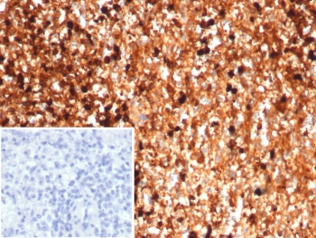 IHC staining of FFPE human spleen tissue with S100A9 antibody (clone S100A9/7553). Inset: PBS used in place of primary Ab (secondary Ab negative control). HIER: boil tissue sections in pH 9 10mM Tris with 1mM EDTA for 20 min and allow to cool before testing.~