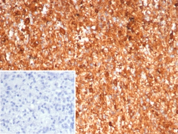IHC staining of FFPE human spleen tissue with Calprotectin antibody (clone S100A9/7551). Inset: PBS used in place of primary Ab (secondary Ab negative control). HIER: boil tissue sections in pH 9 10mM Tris with 1mM EDTA for 20 min and allow to cool before testing.~