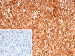 IHC staining of FFPE human spleen tissue with Calprotectin antibody (clone S100A9/7551). Inset: PBS used in place of primary Ab (secondary Ab negative control). HIER: boil tissue sections in pH 9 10mM Tris with 1mM EDTA for 20 min and allow to cool before testing.