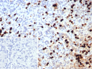 IHC staining of FFPE human spleen tissue with Calprotectin antibody (clone S100A9/7552). Inset: PBS used in place of primary Ab (secondary Ab negative control). HIER: boil tissue sections in pH 9 10mM Tris with 1mM EDTA for 20 min and allow to cool before testing.~