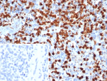 IHC staining of FFPE human spleen tissue with Calprotectin antibody (clone S100A9/7548). Inset: PBS used in place of primary Ab (secondary Ab negative control). HIER: boil tissue sections in pH 9 10mM Tris with 1mM EDTA for 20 min and allow to cool before testing.~