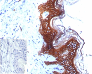 IHC staining of FFPE human skin tissue with S100