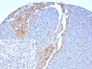 IHC staining of FFPE human tonsil with CD64 antibody (clone FCGR1A/7496) at 2ug/ml. Inset: PBS used in place of primary Ab (secondary Ab negative control). HIER: boil tissue sections in pH 9 10mM Tris with 1mM EDTA for 20 min and allow to cool before testing.~