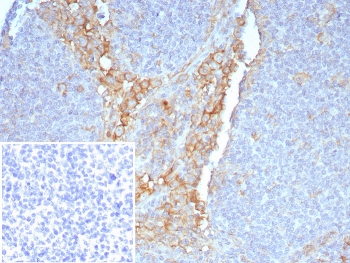 IHC staining of FFPE human tonsil tissue with FCGR1A antibody (clone FCGR1A/7497) at 2ug/ml. Inset: PBS used in place of primary Ab (secondary Ab negative control). HIER: boil tissue sections in pH 9 10mM Tris with 1mM EDTA for 20 min and allow to cool before testing.~