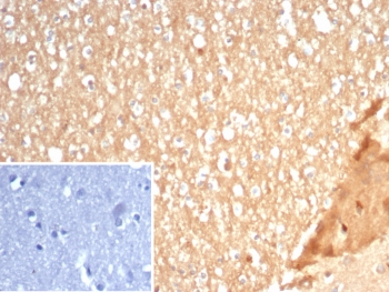 IHC staining of FFPE human brain tissue with S100A5 antibody (clone S100A5/7472). Inset: PBS used in place of primary Ab (secondary Ab negative control). HIER: boil tissue sections in pH 9 10mM Tris with 1mM EDTA for 20 min and allow to cool before testing.~