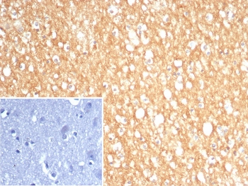 IHC staining of FFPE human brain tissue with S100A5 antibody (clone S100A5/7474). Inset: PBS used in place of primary Ab (secondary Ab negative control). HIER: boil tissue sections in pH 9 10mM Tris with 1mM EDTA for 20 min and allow to cool before testing.~