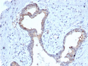 IHC staining of FFPE human prostate tissue with S100 calcium binding protein A5 antibody (clone S100A5/7475). HIER: boil tissue sections in pH 9 10mM Tris with 1mM EDTA for 20 min and allow to cool before testing.~