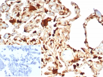 IHC staining of FFPE human lung tissue with S100A11 antibody (clone S100A11/7392). Inset: PBS used in place of primary Ab (secondary Ab negative control). HIER: boil tissue sections in pH 9 10mM Tris with 1mM EDTA for 20 min and allow to cool before testing.~