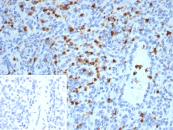 IHC staining of FFPE human spleen tissue with S100 calcium-binding protein A13 antibody (clone S100A13/7482). Inset: PBS used in place of primary Ab (secondary Ab negative control). HIER: boil tissue sections in pH 9 10mM Tris with 1mM EDTA for 20 min and allow to cool before testing.~