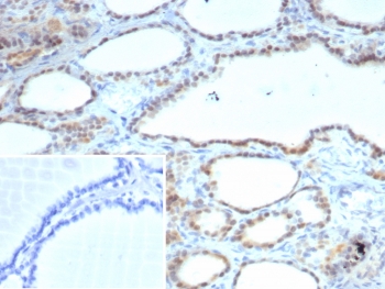 IHC staining of FFPE human thyroid tissue with S100A13 antibody (clone S100A13/7484). Inset: PBS used in place of primary Ab (secondary Ab negative control). HIER: boil tissue sections in pH 9 10mM Tris with 1mM EDTA for 20 min and allow to cool before testing.~