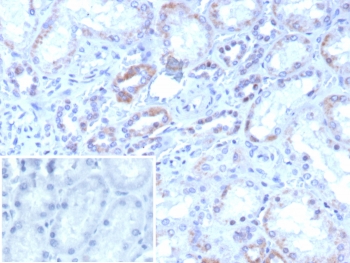 IHC staining of FFPE human kidney tissue with ROR