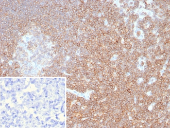 IHC staining of FFPE human lymph node tissue with recombinant CD48 antibody (clone rCD48/8676). Inset: PBS used in place of primary Ab (secondary Ab negative control). HIER: boil tissue sections in pH 9 10mM Tris with 1mM EDTA for 20 min and allow to cool before testing.~