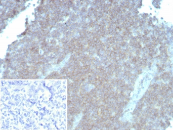 IHC staining of FFPE human tonsil tissue with CD48 antibody (clone rCD48/8834). Inset: PBS used in place of primary Ab (secondary Ab negative control). HIER: boil tissue sections in pH 9 10mM Tris with 1mM EDTA for 20 min and allow to cool before testing.~