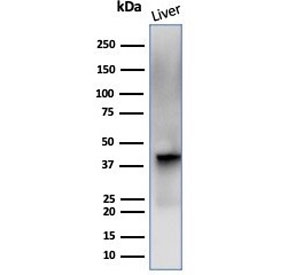 Western blot testing of human liver tissue lysate with Glutamine Synthetase antibody (clone GLUL/6601). Predicted molecular weight ~42 kDa.~