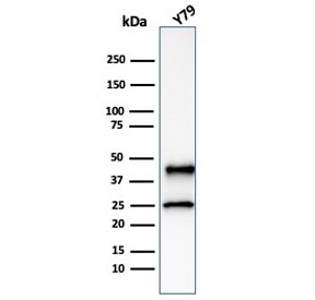 Western blot testing of human Y79 cell lysate with Glutamine Synthetase antibody (clone GLUL/6601)