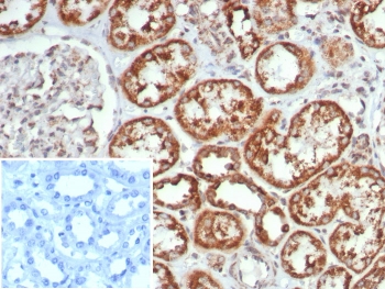 IHC staining of FFPE human kidney tissue with MR1 antibody (clone MR1/7579). Inset: PBS used in place of primary Ab (secondary Ab negative control). HIER: boil tissue sections in pH 9 10mM Tris with 1mM EDTA for 20 min and allow to cool before testing.~