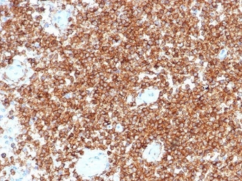 IHC staining of FFPE human tonsil tissue with CD45RA antibody (clone PTPRC/4367R). HIER: boil tissue sections in pH 9 10mM Tris with 1mM EDTA for 20 min and allow to cool before testing.~