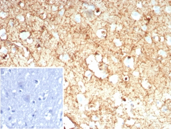 IHC staining of FFPE human brain tissue with GLUL antibody (clone rGLUL/8621). Inset: PBS used in place of primary Ab (secondary Ab negative control). HIER: boil tissue sections in pH 9 10mM Tris with 1mM EDTA for 20 min and allow to cool before testing.~