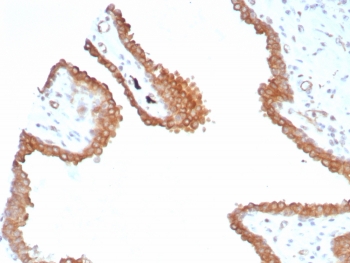 IHC staining of FFPE human prostate tissue with GLUL antibody (clone GLUL/8517R). HIER: boil tissue sections in pH 9 10mM Tris with 1mM EDTA for 20 min and allow to cool before testing.~