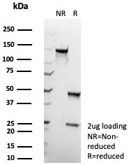 SDS-PAGE analysis of purified, BSA-free GLUL antibod