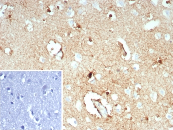 IHC staining of FFPE human brain tissue with GLUL antibody (clone GLUL/8619R). HIER: boil tissue sections in pH 9 10mM Tris with 1mM EDTA for 20 min and allow to cool before testing.~