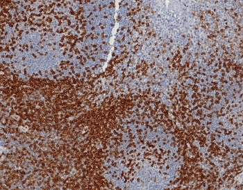 IHC staining of FFPE human tonsil tissue with CD45RA antibody (clone PTPRC/8124R). HIER: boil tissue sections in pH 9 10mM Tris with 1mM EDTA for 20 min and allow to cool before testing.~