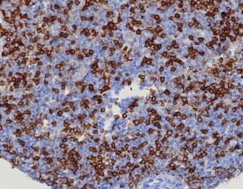 IHC staining of FFPE human tonsil tissue with CD45R