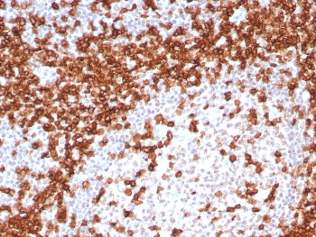 IHC staining of FFPE human tonsil tissue with CD45RA antibody (clone T200/8144R). HIER: boil tissue sections in pH 9 10mM Tris with 1mM EDTA for 20 min and allow to cool before testing.~
