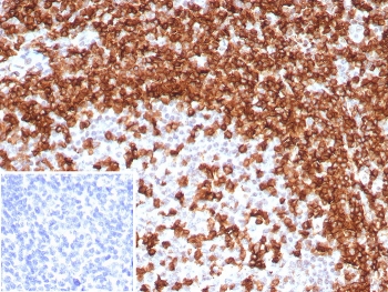 IHC staining of FFPE human tonsil tissue with CD45RA