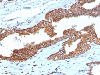 IHC staining of FFPE human prostate tissue with Cyclooxygenase 2 antibody (clone COX2/7803R). HIER: boil tissue sections in pH 9 10mM Tris with 1mM EDTA for 20 min and allow to cool before testing.~