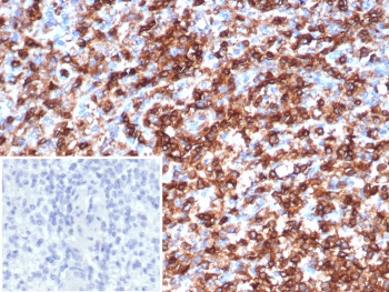 IHC staining of FFPE human spleen tissue with CD45 antibody (clone rPTPRC/