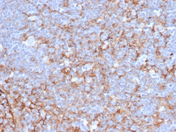 IHC staining of FFPE human tonsil tissue with CD21 antibody (clone CR2/6683). HIER: boil tissue sections in pH 9 10mM Tris with 1mM EDTA for 20 min and allow to cool before testing.~