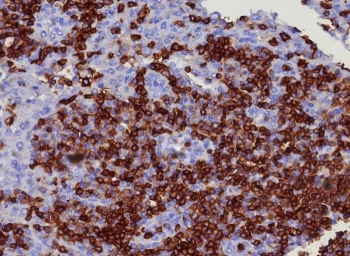 IHC staining of FFPE human lymph node tissue with CD45RA antibody (clone PTPRC/8341R). HIER: boil tissue sections in pH 9 10mM Tris with 1mM EDTA for 20 min and allow to cool before testing.~