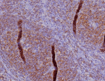 IHC staining of FFPE human tonsil tissue with C