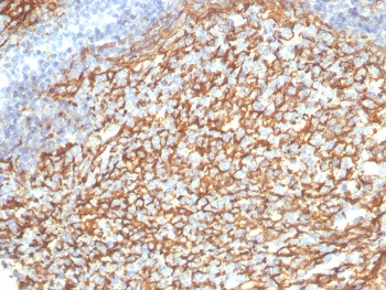 IHC staining of FFPE human tonsil tissue with CD21 antibody (clone CR2/7185R). HIER: boil tissue sections in pH 9 10mM Tris with 1mM EDTA for 20 min and allow to cool before testing.~