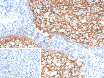 IHC staining of FFPE human tonsil tissue with CD21 anti